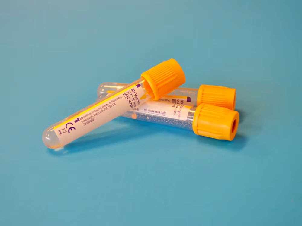 Thyroid report information reviewed in a laboratory